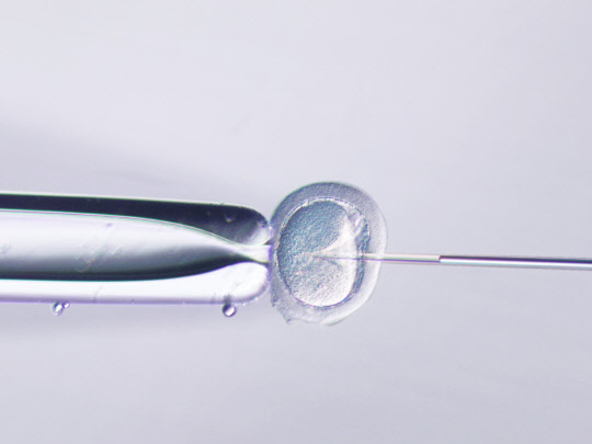 특수 현미경으로 보며 난자에 정자를 주입하는 모습. 올림푸스한국 제공